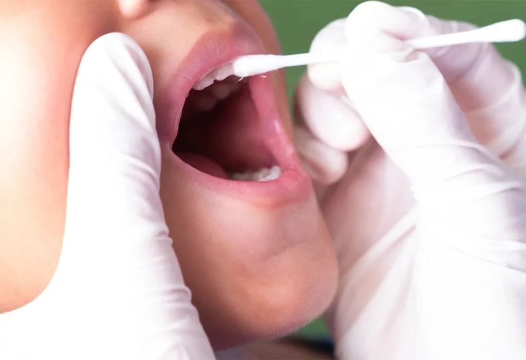 Fluoride Treatment